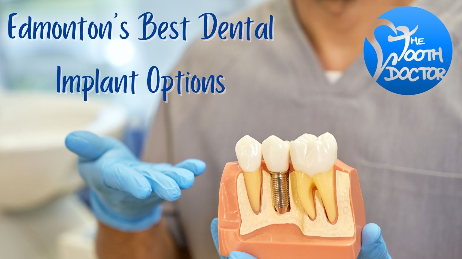 Edmonton's Best Dental Implant Options