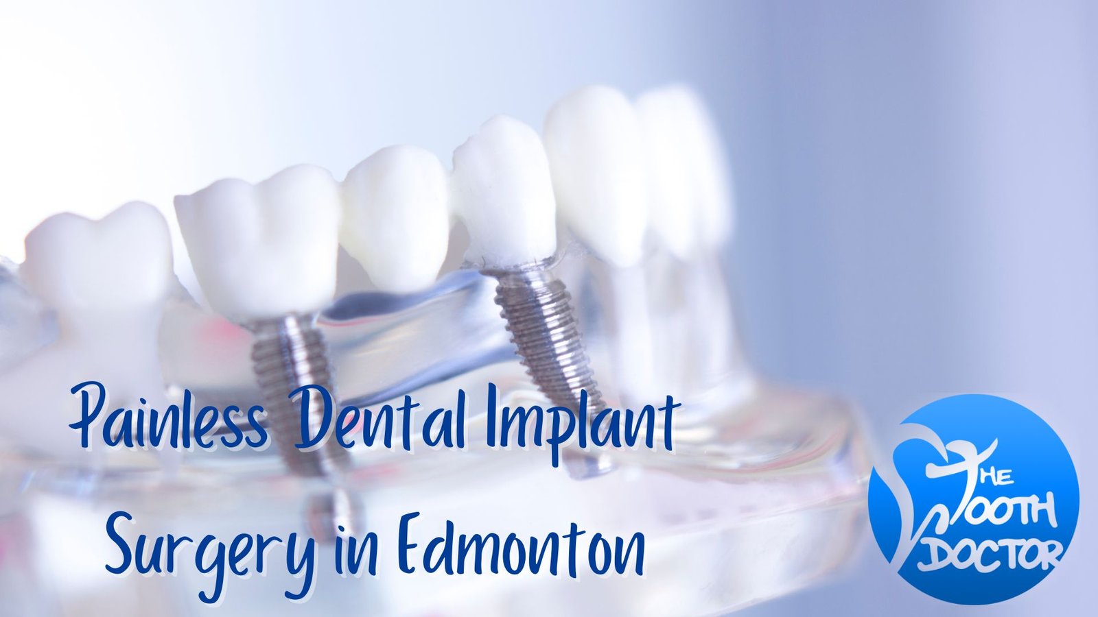 Get Dental Implant Surgery in Edmonton