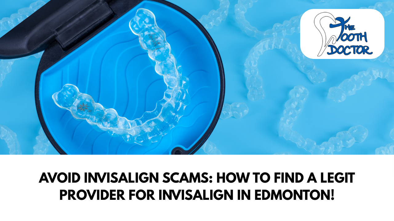 Invisalign in Edmonton