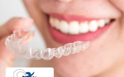 Invisalign Edmonton – The Top 5 Mistakes People Make in with Aligners!