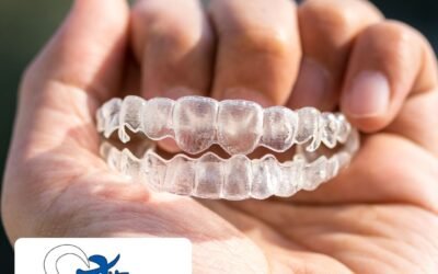 How Long Does Invisalign Take? Timelines for Invisalign Edmonton Dental Patients!