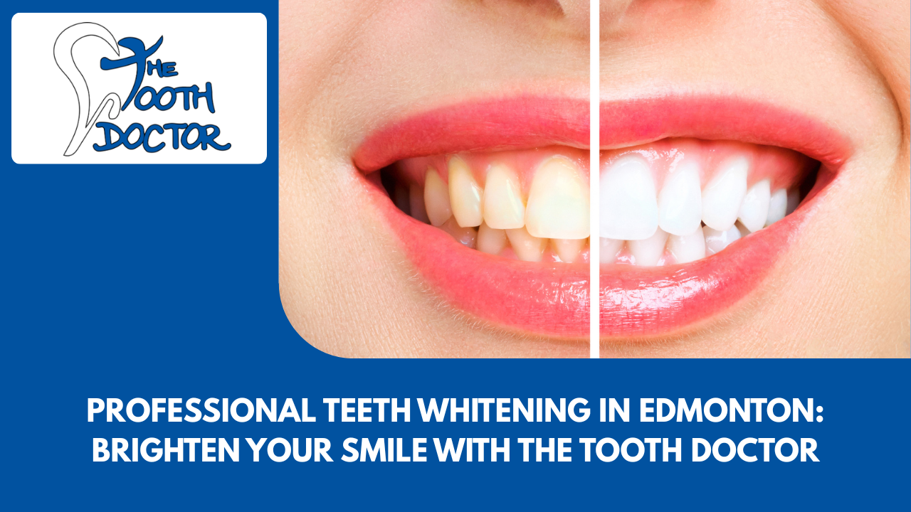Professional Teeth Whitening in Edmonton
