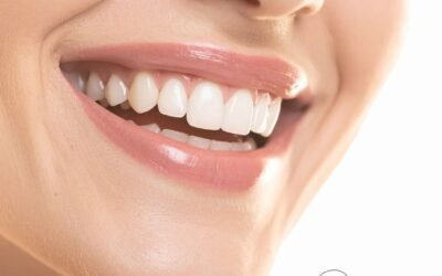 Custom Teeth Whitening in Edmonton: Enhance Your Smile with The Tooth Doctor